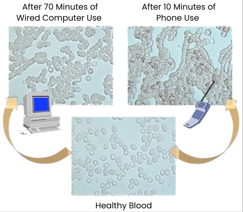 Illustration of rouleau formation and blood cell clumping caused by EMF radiation exposure